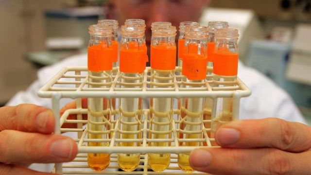 Pourquoi on ne peut pas rechercher le glyphosate dans les urines en Suisse