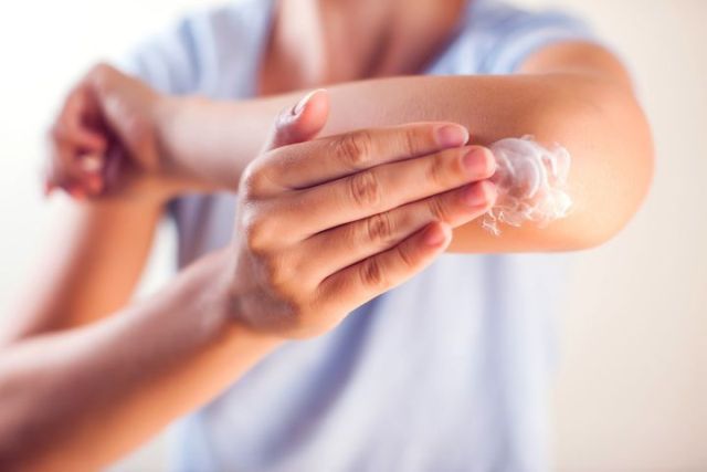 Allergies, eczéma, psoriasis… les bons soins contre les démangeaisons